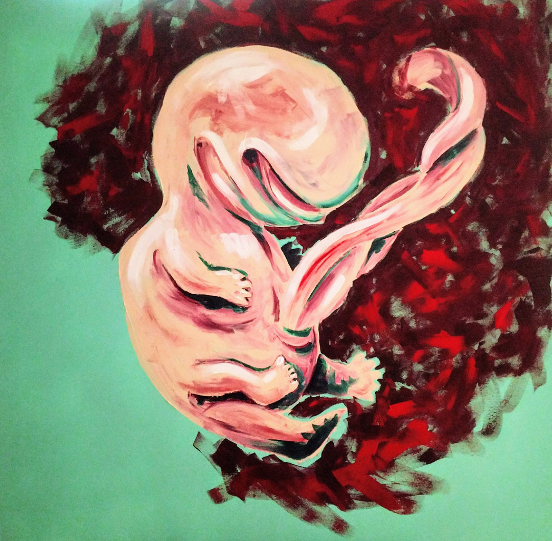 A grinning four-legged fetus on a jagged cloud of red, the placenta, and a mint green background.